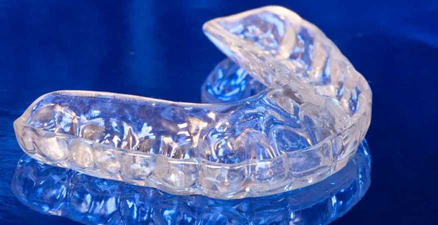 A clear, custom-fitted dental splint used in TMJ treatment